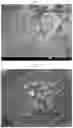 Fig. 02 - Method of producing a microsphere comprising PLGA or PLA in which a biologically active substance is uniformly dispersed