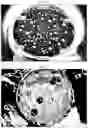 Fig. 07 - Method of producing a microsphere comprising PLGA or PLA in which a biologically active substance is uniformly dispersed