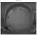 Fig. 08 - Method of producing a microsphere comprising PLGA or PLA in which a biologically active substance is uniformly dispersed