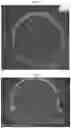 Fig. 09 - Method of producing a microsphere comprising PLGA or PLA in which a biologically active substance is uniformly dispersed