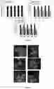 Fig. 11 - BIODEGRADABLE EXTENDED RELEASE MICROSPHERE-HYDROGEL OCULAR DRUG DELIVERY SYSTEM AND METHOD