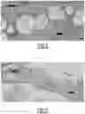 Fig. 03 - CAPSULE COMPRISING INSULIN-SECRETING CELLS FOR TREATING DIABETES