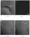 Fig. 04 - Methods of treating disorders associated with glycosylation defective proteins