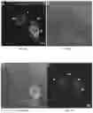 Fig. 05 - Methods of treating disorders associated with glycosylation defective proteins