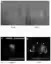 Fig. 06 - Methods of treating disorders associated with glycosylation defective proteins