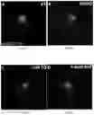 Fig. 09 - Methods of treating disorders associated with glycosylation defective proteins