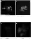 Fig. 10 - Methods of treating disorders associated with glycosylation defective proteins