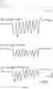 Fig. 14 - Methods of treating disorders associated with glycosylation defective proteins