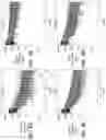 Fig. 10 - Methods of treating Fabry patients having renal impairment