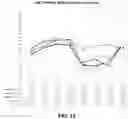 Fig. 20 - METHODS FOR TREATING SYMPTOMATIC ORTHOSTATIC HYPOTENSION