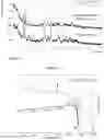 Fig. 15 - SALTS OF A COMPOUND, CRYSTAL FORMS OF THE SALTS AND PREPARATION METHOD AND USE THEREOF