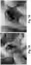 Fig. 02 - Therapeutic Thiazine Dye Compositions and Methods of Use