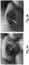 Fig. 04 - Therapeutic Thiazine Dye Compositions and Methods of Use