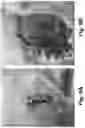 Fig. 10 - Therapeutic Thiazine Dye Compositions and Methods of Use