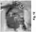 Fig. 13 - Therapeutic Thiazine Dye Compositions and Methods of Use