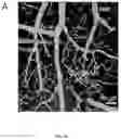 Fig. 19 - METHODS TO PROMOTE CEREBRAL BLOOD FLOW IN THE BRAIN