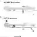 Fig. 24 - METHODS TO PROMOTE CEREBRAL BLOOD FLOW IN THE BRAIN