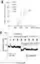 Fig. 32 - METHODS TO PROMOTE CEREBRAL BLOOD FLOW IN THE BRAIN