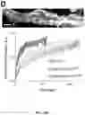Fig. 41 - METHODS TO PROMOTE CEREBRAL BLOOD FLOW IN THE BRAIN