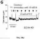 Fig. 43 - METHODS TO PROMOTE CEREBRAL BLOOD FLOW IN THE BRAIN