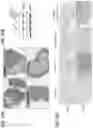 Fig. 13 - THERAPEUTIC COMBINATIONS COMPRISING ANTI-FOLR1 IMMUNOCONJUGATES