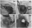 Fig. 01 - SYSTEM AND METHOD TO REDUCE TISSUE ORORGAN ADHESION