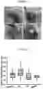 Fig. 02 - SYSTEM AND METHOD TO REDUCE TISSUE ORORGAN ADHESION