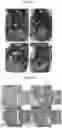Fig. 04 - SYSTEM AND METHOD TO REDUCE TISSUE ORORGAN ADHESION