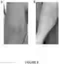 Fig. 10 - Anti-Inflammatory Compositions and Methods