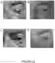 Fig. 11 - Anti-Inflammatory Compositions and Methods