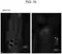 Fig. 07 - Method for producing biological tissue-like structure