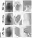 Fig. 14 - METHODS AND COMPOSITIONS FOR PRODUCING HEPATOCYTE-LIKE CELLS