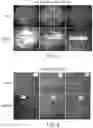 Fig. 06 - METHODS FOR MEASURING THERAPEUTIC EFFECTS OF RETINAL DISEASE THERAPIES