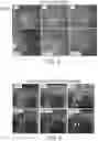 Fig. 07 - METHODS FOR MEASURING THERAPEUTIC EFFECTS OF RETINAL DISEASE THERAPIES