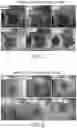Fig. 08 - METHODS FOR MEASURING THERAPEUTIC EFFECTS OF RETINAL DISEASE THERAPIES