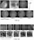 Fig. 09 - METHODS FOR MEASURING THERAPEUTIC EFFECTS OF RETINAL DISEASE THERAPIES