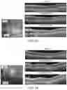 Fig. 12 - METHODS FOR MEASURING THERAPEUTIC EFFECTS OF RETINAL DISEASE THERAPIES