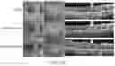 Fig. 13 - METHODS FOR MEASURING THERAPEUTIC EFFECTS OF RETINAL DISEASE THERAPIES