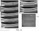 Fig. 14 - METHODS FOR MEASURING THERAPEUTIC EFFECTS OF RETINAL DISEASE THERAPIES