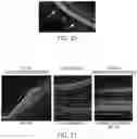Fig. 16 - METHODS FOR MEASURING THERAPEUTIC EFFECTS OF RETINAL DISEASE THERAPIES