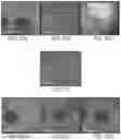 Fig. 17 - METHODS FOR MEASURING THERAPEUTIC EFFECTS OF RETINAL DISEASE THERAPIES