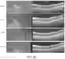 Fig. 18 - METHODS FOR MEASURING THERAPEUTIC EFFECTS OF RETINAL DISEASE THERAPIES