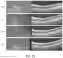 Fig. 19 - METHODS FOR MEASURING THERAPEUTIC EFFECTS OF RETINAL DISEASE THERAPIES