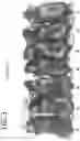 Fig. 04 - ELASTASE ACTIVITY INHIBITOR, ELASTASE ACTIVITY INHIBITING TOPICAL AGENT, AND ELASTASE ACTIVITY INHIBITING FOOD AND BEVERAGE COMPOSITION