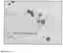 Fig. 11 - IL-12 COMPOSITIONS AND METHODS OF USE IN HEMATOPOIETIC RECOVERY