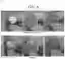 Fig. 05 - Hemostatic agent and container containing the same