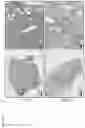 Fig. 16 - METHODS AND COMPOSITIONS FOR THE TREATMENT OF CORONAVIRUS INFECTION, INCLUDING SARS-COV-2