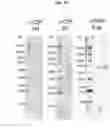 Fig. 13 - Vaccines