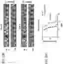 Fig. 32 - COMPOSITIONS AND METHODS FOR TREATING AUTOIMMUNE DISEASES AND CANCERS