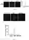 Fig. 10 - APPLICATION OF TRANSTHYRETIN IN ENTERING EYE AND PREPARING DROP